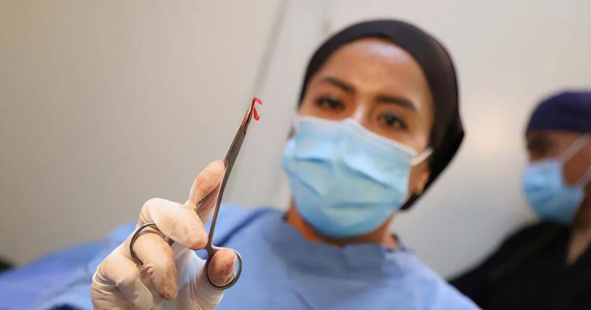 Campaña gratuita de vasectomía con bisturí - Campañas - Hospital Santa Campaña gratuita de vasectomía con bisturí - Campañas - Hospital Santa