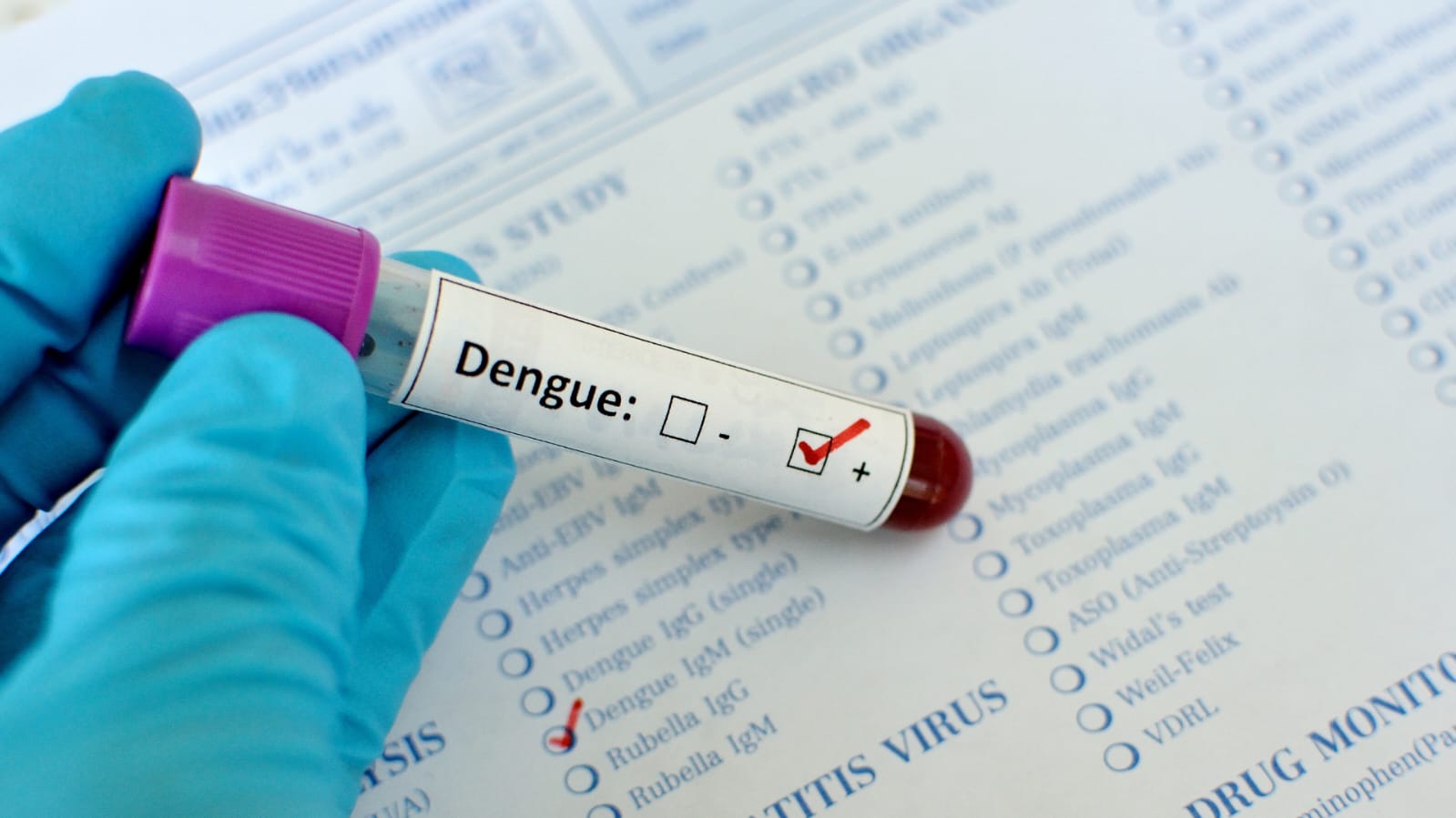 Siguen casos de dengue pese a descenso de temperatura