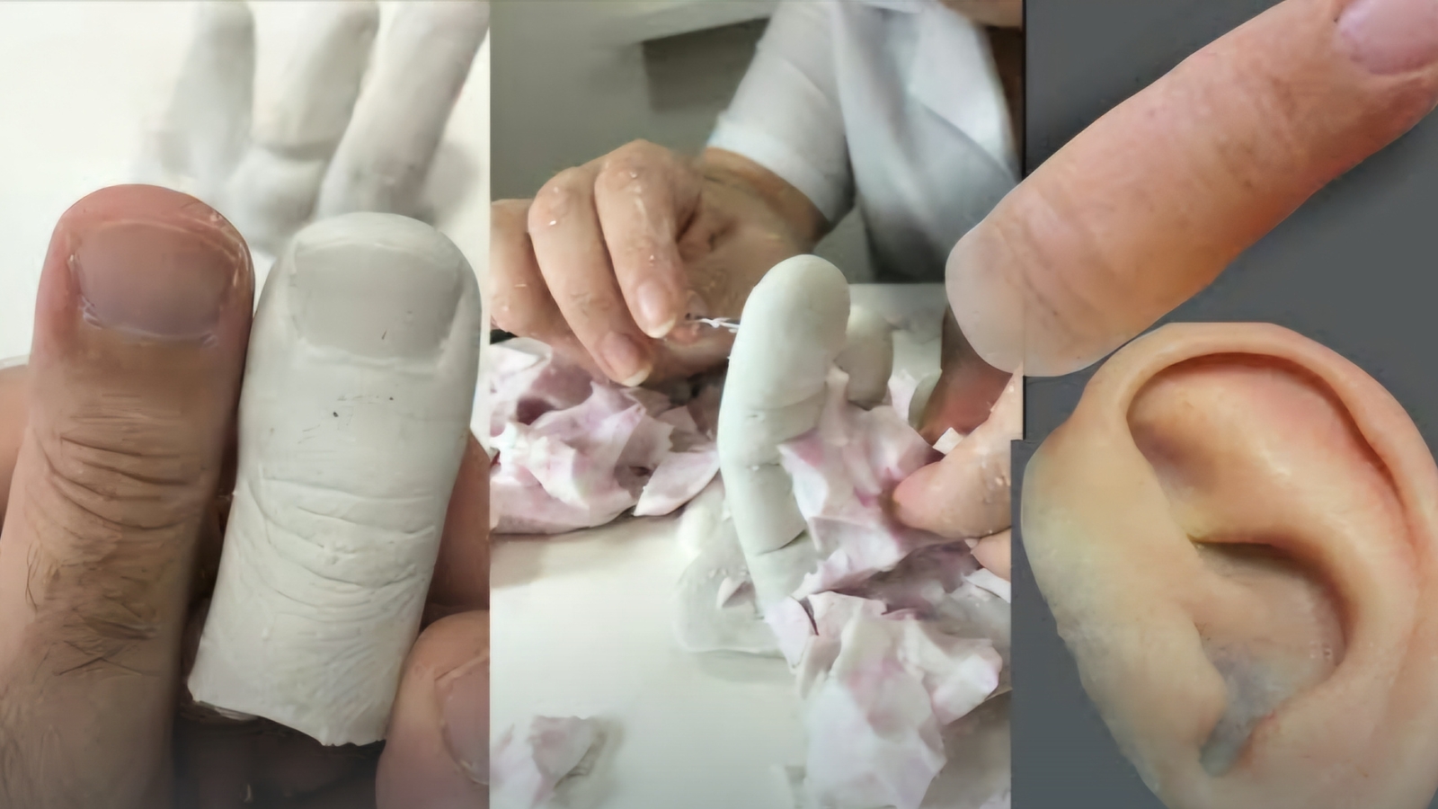 Lanza DIF de Ocuituco programa de Prótesis Maxilofacial
