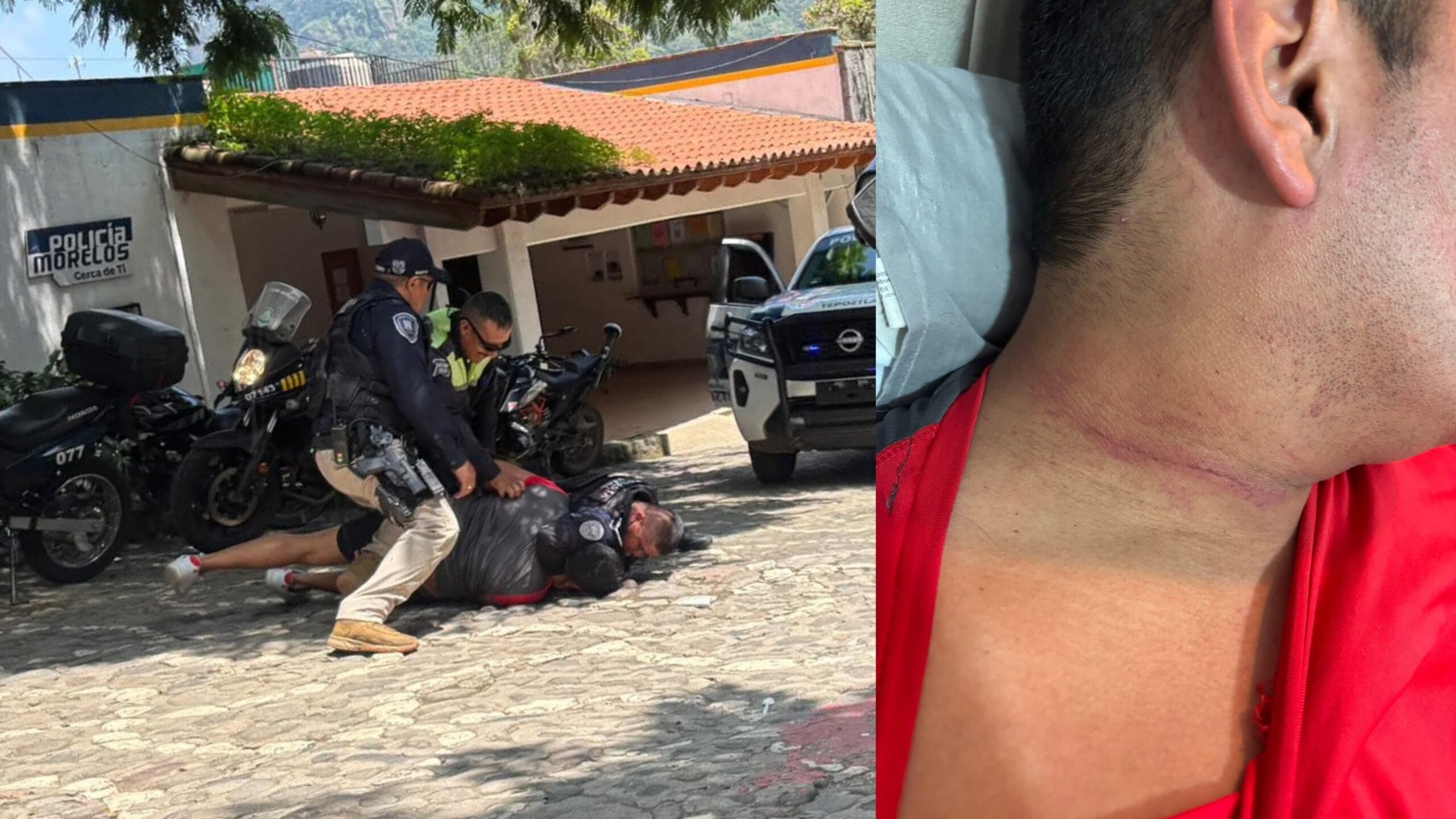 Sufre pareja brutal agresión y detención ilegal por policías en Tepoztlán
