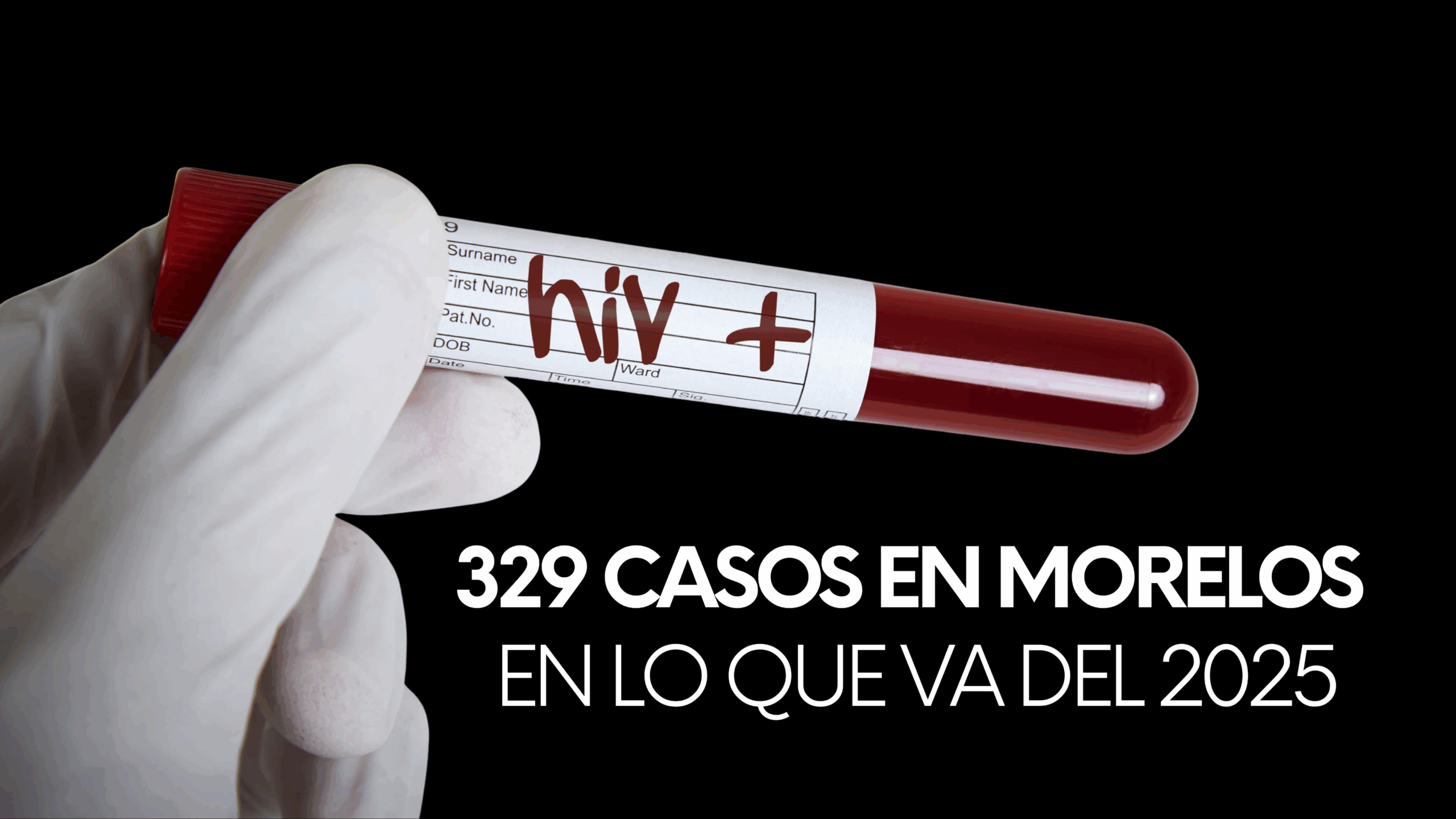 329 nuevos casos de VIH en Morelos en el primer semestre del año