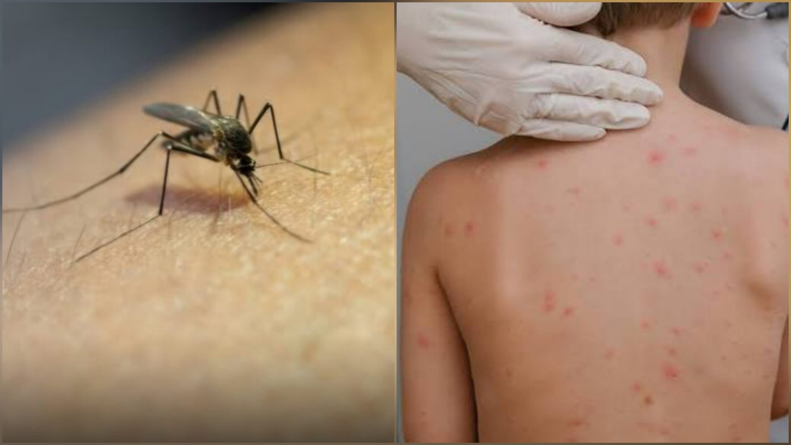 Registra Morelos una disminución del 97% en casos de dengue