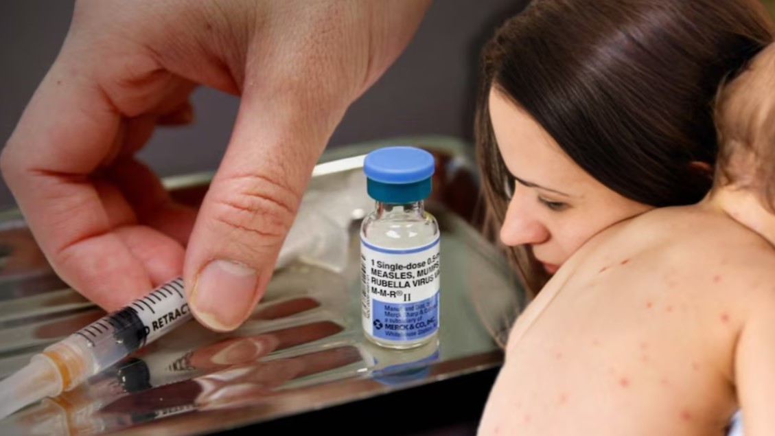 Llama Hospital de la Niñez Morelense a no bajar la guardia contra el sarampión