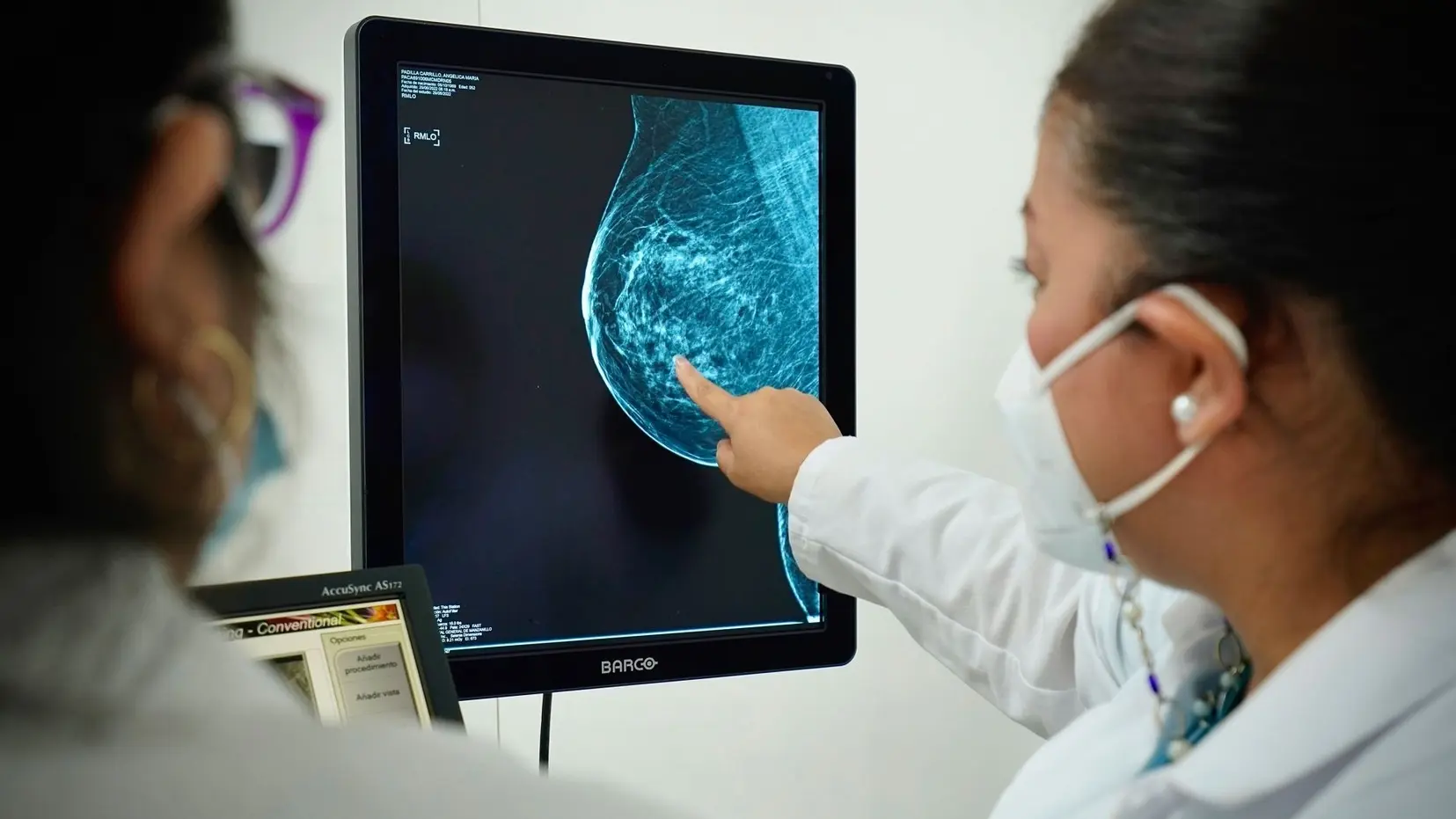 Aumentan casos de cáncer de mama en mujeres jóvenes