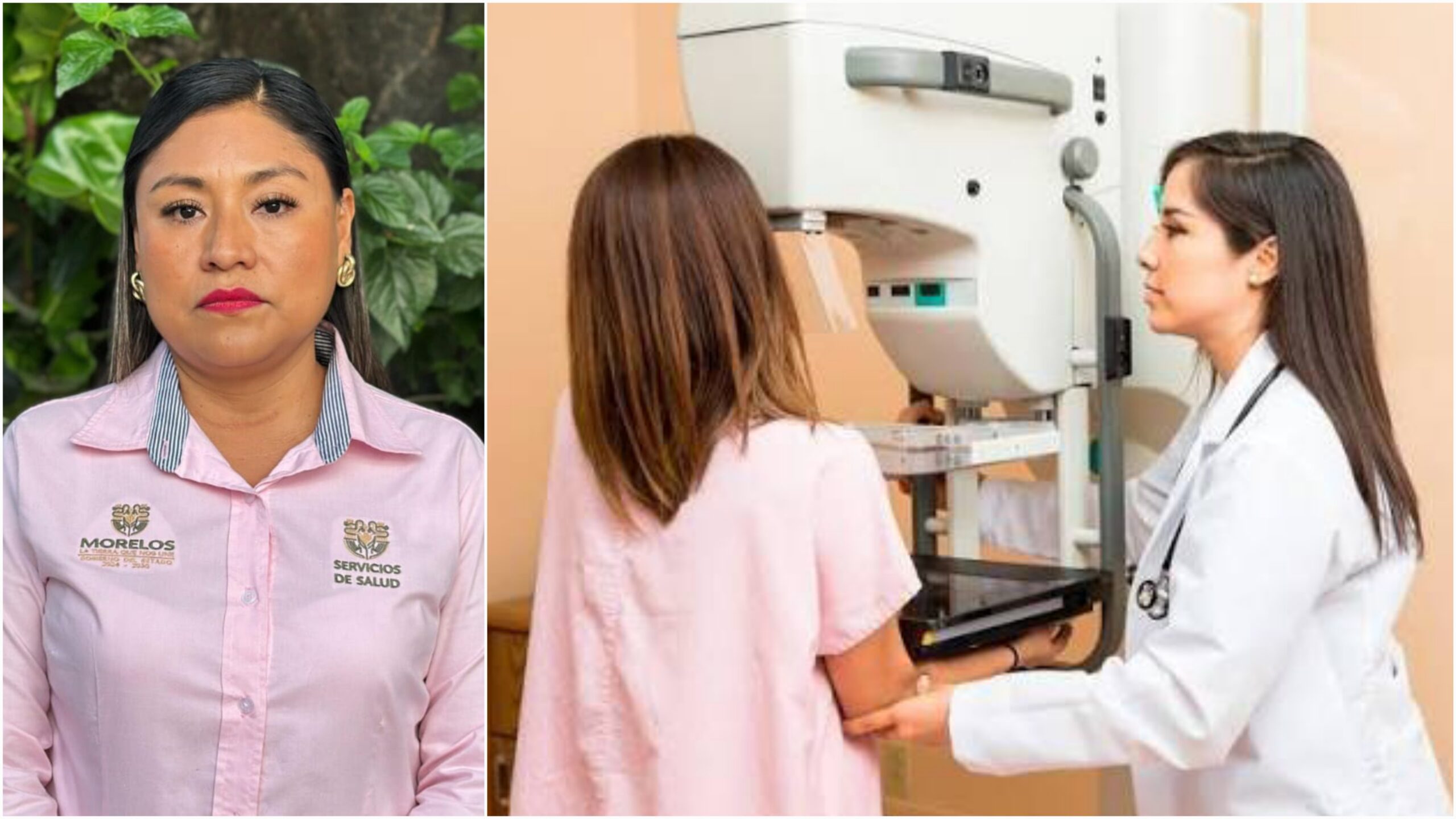 Refuerzan servicios de mastografía en Yecapixtla y Yautepec
