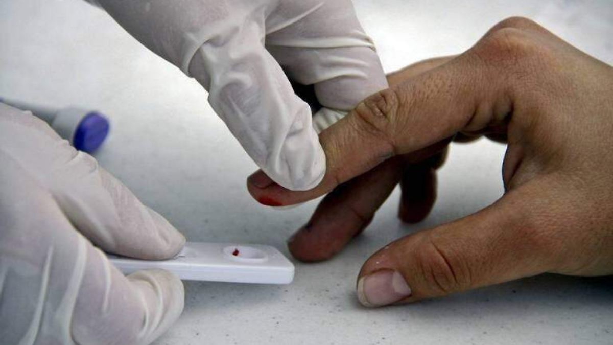 Morelos se ubica en el lugar 16 a nivel nacional en casos de VIH/SIDA