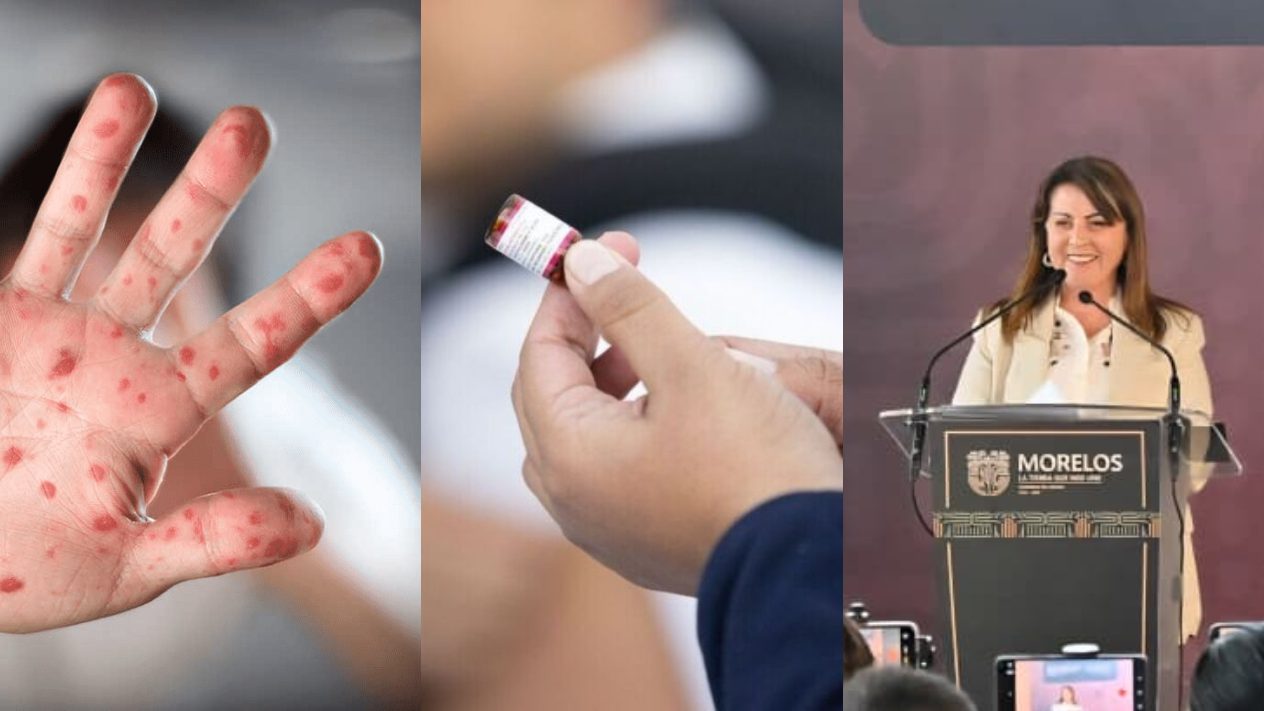 Morelos intensifica vacunación contra el sarampión