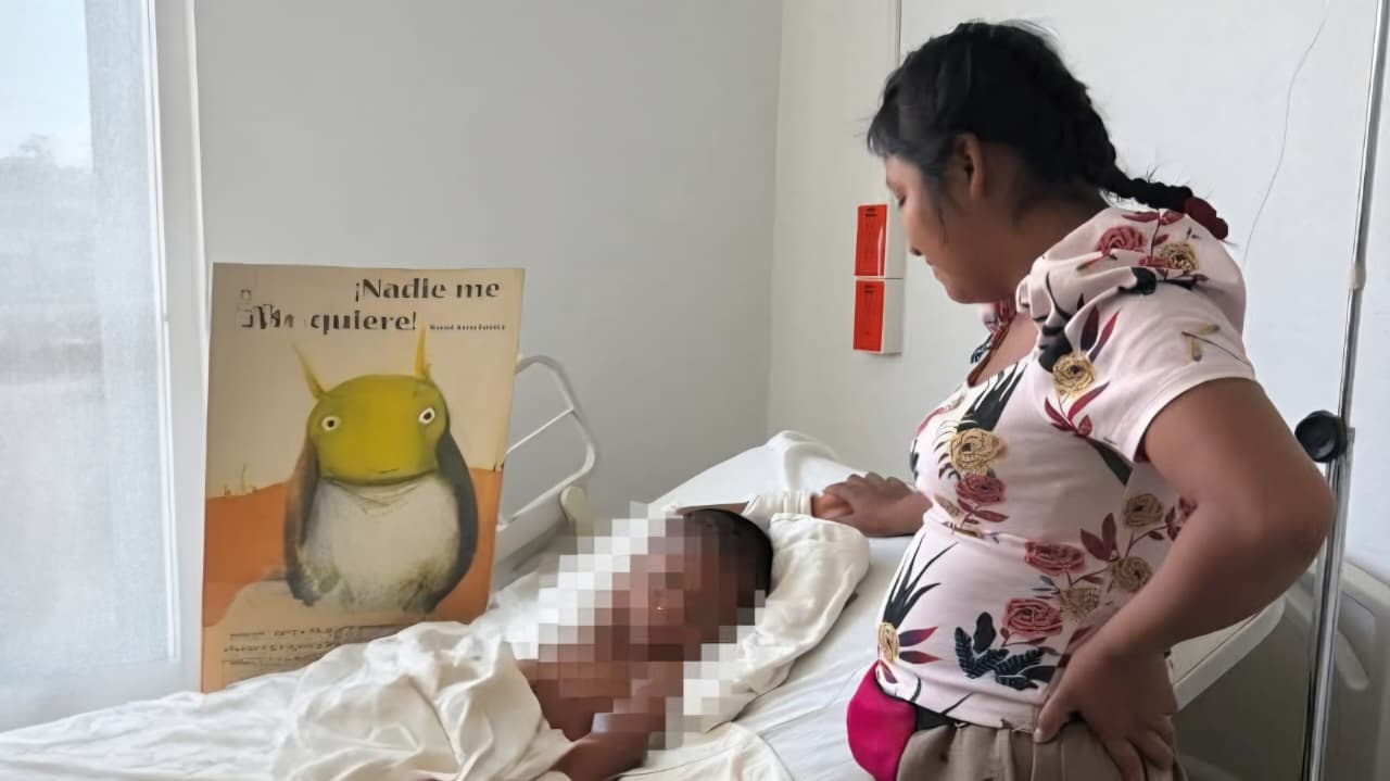 Especialistas en Morelos salvan la vida de menor tras grave traumatismo craneal